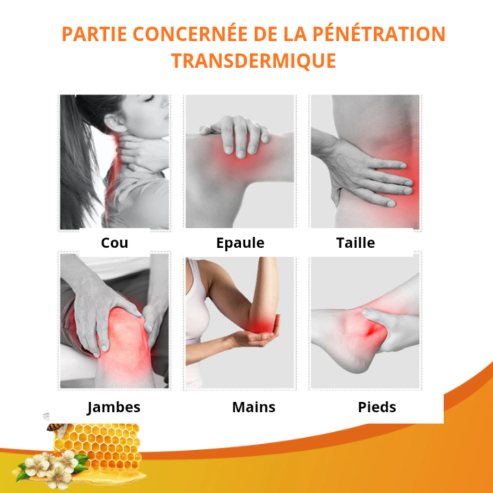 Pommade professionnelle anti-douleurs articulaires, musculaires au venin d'abeille